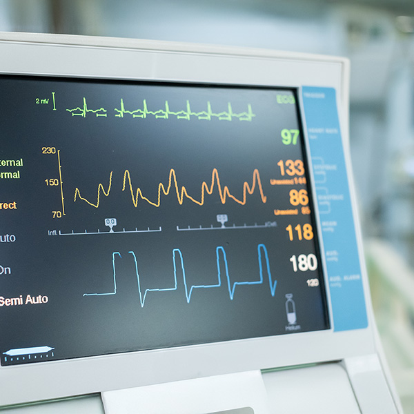 EKG (Electorcardiograms)